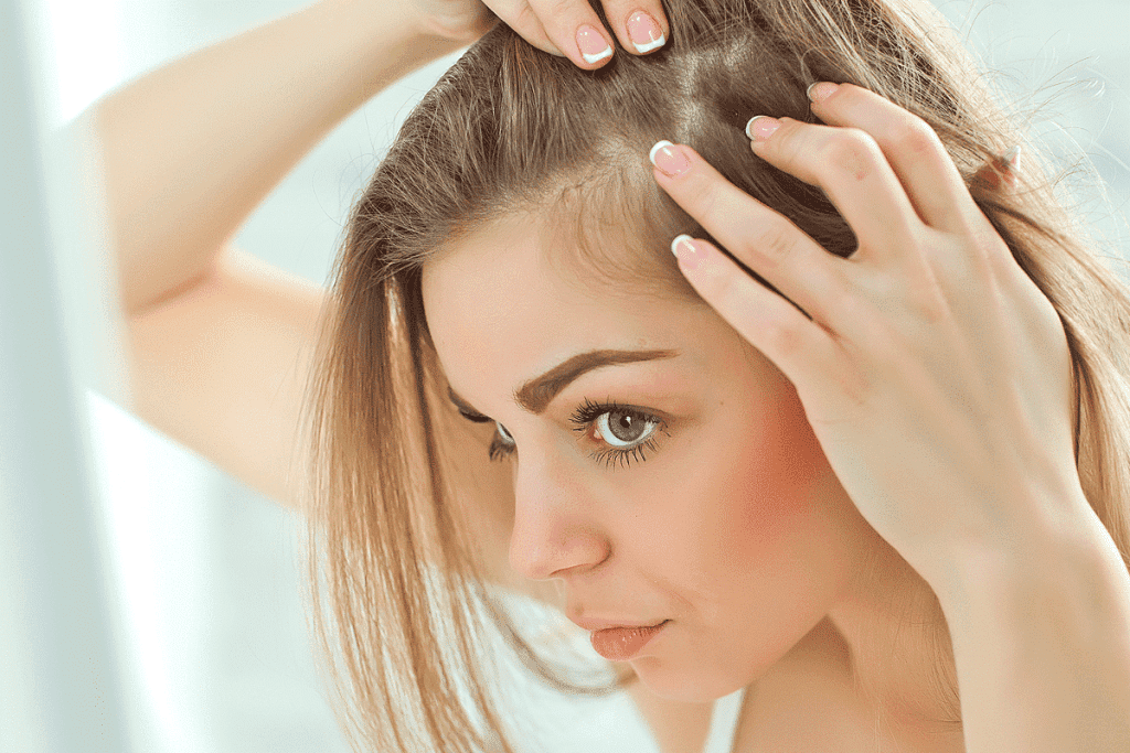 Eflúvio Telógeno Crônico