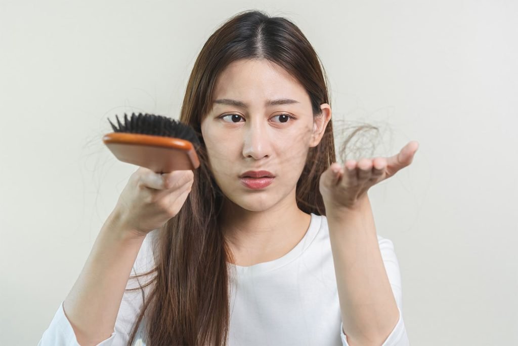 alopécia androgenética