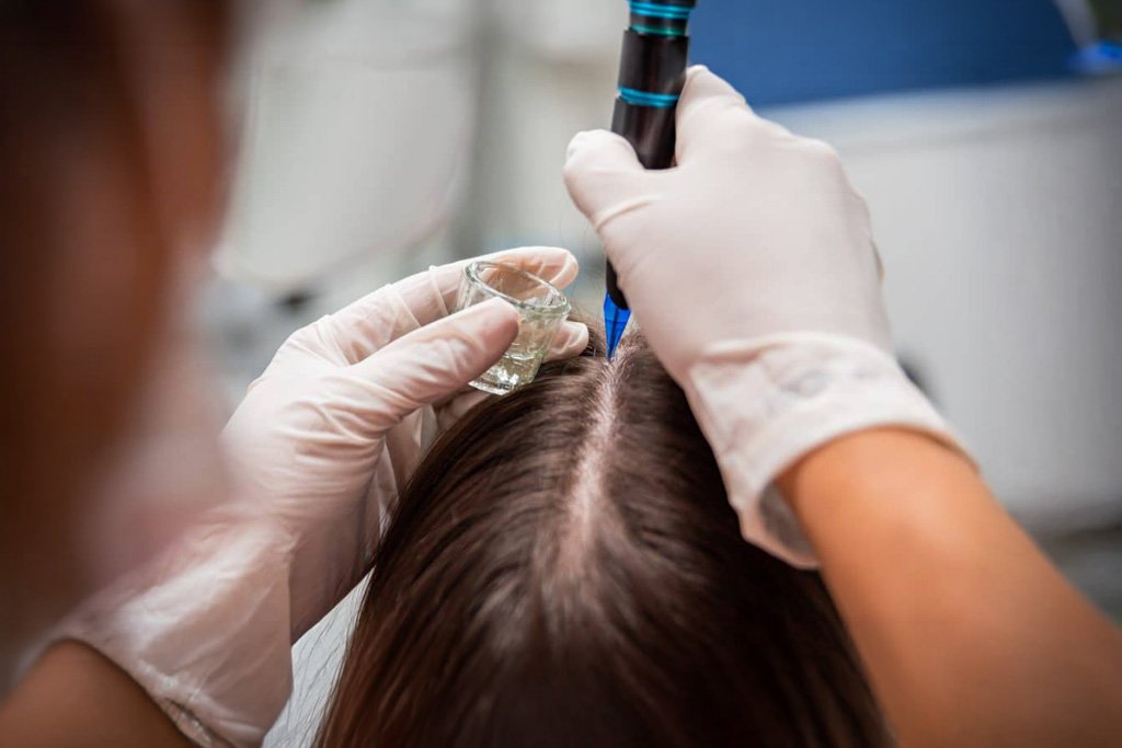 Biópsia do Couro Cabeludo