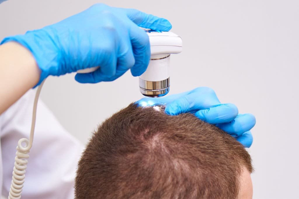 avaliação com um tricologista