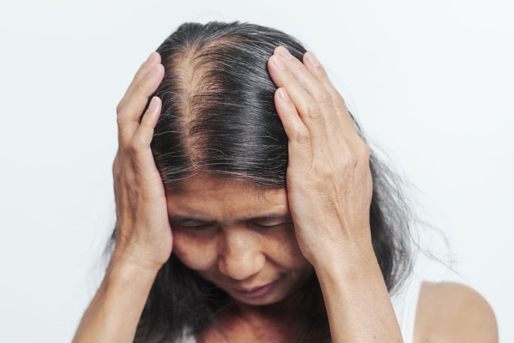 queda de cabelo na menopausa