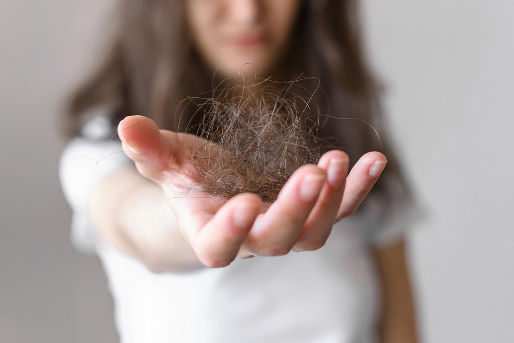 O que é Alopecia e Quais São os Tipos e Tratamentos?